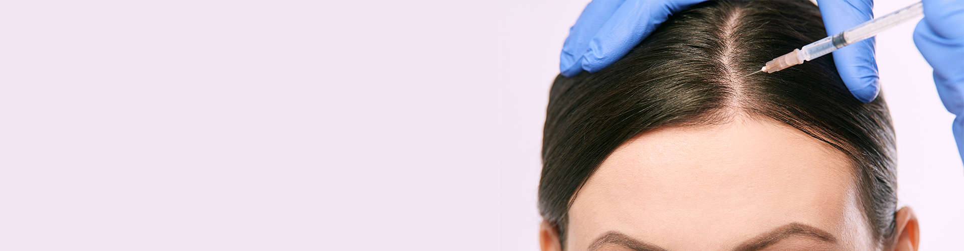 Scalp Hair Transplant